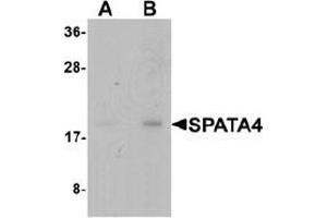Western blot analysis of SPATA4 in mouse stomach tissue lysate with SPATA4 Antibody  at (A) 1 and (B) 2 μg/mL (SPATA4 antibody  (C-Term))