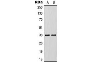 Western blot analysis of KLF1/5/7 expression in Jurkat (A), VEC (B) whole cell lysates. (KLF1/5/7 antibody  (C-Term))
