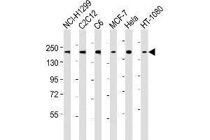 Western Blotting (WB) image for anti-rho-Associated, Coiled-Coil Containing Protein Kinase 2 (ROCK2) (AA 1346-1380), (C-Term) antibody (ABIN6242867)