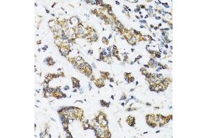 Immunohistochemistry (Paraffin-embedded Sections) (IHC (p)) image for anti-Dehydrogenase/reductase (SDR Family) Member 2 (DHRS2) (AA 1-300) antibody (ABIN6139594)