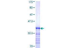 HIP1R Protein (AA 969-1066) (GST tag)