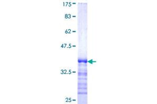HIP1R Protein (AA 969-1066) (GST tag)