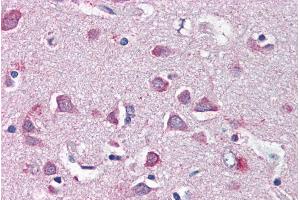 ABIN334445 (5µg/ml) staining of paraffin embedded Human Cortex. (Merlin antibody  (Internal Region))