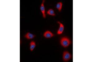 Immunofluorescent analysis of IKB epsilon (pS22) staining in HeLa cells. (NFKBIE antibody  (pSer22))