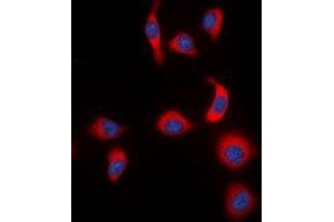 Immunofluorescent analysis of IKB epsilon (pS22) staining in HeLa cells.