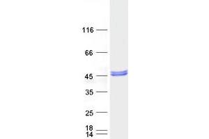 Western Blotting (WB) image for Prenyl (Decaprenyl) Diphosphate Synthase, Subunit 2 (PDSS2) protein (Myc-DYKDDDDK Tag) (ABIN2728614)