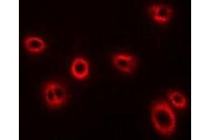 Immunofluorescent analysis of HLA-A staining in U2OS cells. (HLA-A antibody)