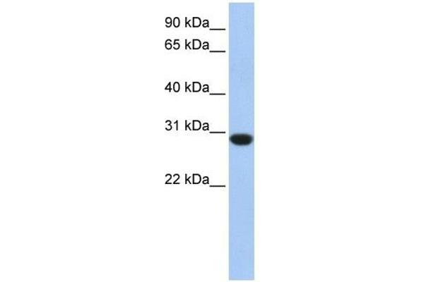 ASB12 antibody  (C-Term)