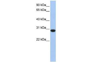 ASB12 antibody used at 1 ug/ml to detect target protein. (ASB12 antibody  (C-Term))