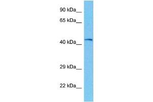 Host:  Mouse  Target Name:  PHKG2  Sample Tissue:  Mouse Kidney  Antibody Dilution:  1ug/ml (PHKG2 antibody  (N-Term))