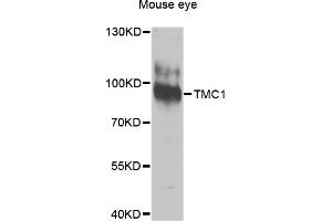 Western blot analysis of extracts of Mouse eye cells, using TMC1 antibody. (TMC1 antibody)