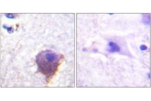 Immunohistochemistry analysis of paraffin-embedded human brain tissue, using MAP4 (Ab-696) Antibody. (MAP4 antibody  (AA 662-711))