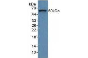 Figure. (COL8A1 antibody  (AA 590-744))