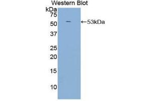 Western Blotting (WB) image for anti-Complement Component (3d/Epstein Barr Virus) Receptor 2 (CR2) (AA 729-957) antibody (ABIN1858487)