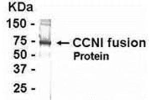 Western Blotting (WB) image for anti-Cyclin I (CCNI) (AA 211-377) antibody (ABIN2468095) (Cyclin I antibody  (AA 211-377))