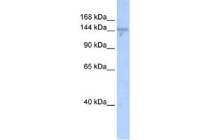 WB Suggested Anti-ZMYND8 Antibody Titration:  0.