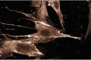Immunofluorescence staining of WI-38 cells (Human lung fibroblasts, ATCC CCL-75). (BAD antibody  (AA 39-198))