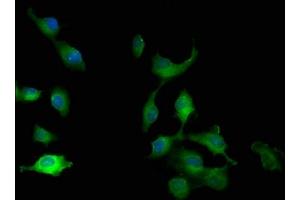 Immunofluorescence staining of U251 cells with ABIN7165606 at 1:100, counter-stained with DAPI.