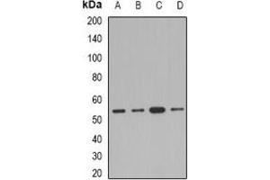 Western blot analysis of AEBP2 expression in Jurkat (A), A549 (B), mouse kidney (C), rat heart (D) whole cell lysates. (AEBP2 antibody)