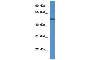 Western Blot showing GC antibody used at a concentration of 1 ug/ml against Placenta Lysate (Gc (N-Term) antibody)