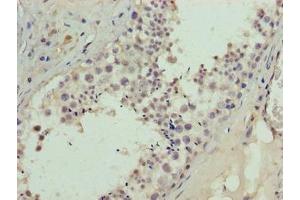 Immunohistochemistry of paraffin-embedded human testis tissue using ABIN7145267 at dilution of 1:100 (BATF2 antibody  (AA 1-189))