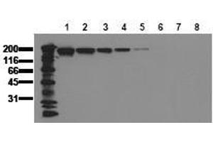 Western Blotting (WB) image for anti-Epidermal Growth Factor Receptor (EGFR) (AA 960-980) antibody (ABIN126763) (EGFR antibody  (AA 960-980))