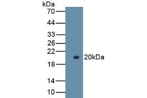 Detection of Recombinant F5, Rat using Polyclonal Antibody to Coagulation Factor V (F5) (Coagulation Factor V antibody  (AA 1944-2099))