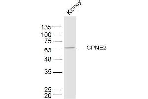 Mouse kidney lysates probed with CPNE2 Polyclonal Antibody, Unconjugated  at 1:300 dilution and 4˚C overnight incubation. (Copine II antibody  (AA 81-180))