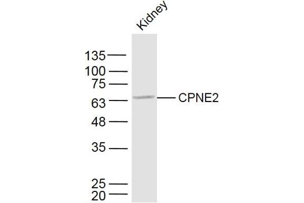 Copine II Antikörper  (AA 81-180)