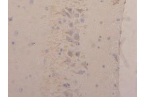 Detection of NGAL in Rat Brain Tissue using Polyclonal Antibody to Neutrophil gelatinase-associated lipocalin (NGAL) (Lipocalin 2 antibody  (AA 21-198))