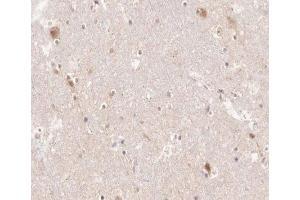 ABIN6266518 at 1/200 staining human brain tissue sections by IHC-P. (PTGS1 antibody  (C-Term))