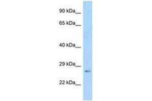 Image no. 1 for anti-Insulin-Like Growth Factor Binding Protein 5 (IGFBP5) (AA 111-160) antibody (ABIN6748153) (IGFBP5 antibody  (AA 111-160))