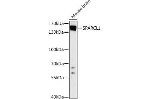 Western blot analysis of extracts of Mouse brain, using SP antibody (ABIN7270512) at 1:1000 dilution. (SPARCL1 antibody  (AA 17-300))