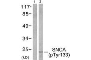 Western blot analysis of extracts from 293 cells treated with Etoposide 25 muM 60', using Synuclein-alpha (Phospho-Tyr133) Antibody. (SNCA antibody  (pTyr133))
