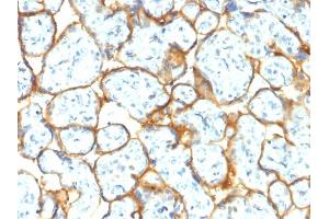 Formalin-fixed, paraffin-embedded human Placenta stained with Insulin Receptor Rabbit Recombinant Monoclonal Antibody (INSR/2277R). (Recombinant Insulin Receptor antibody  (Extracellular Domain))