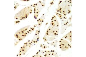 Immunohistochemistry (Paraffin-embedded Sections) (IHC (p)) image for anti-ELAV (Embryonic Lethal, Abnormal Vision, Drosophila)-Like 1 (Hu Antigen R) (ELAVL1) (AA 1-326) antibody (ABIN3022231)