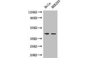 Western Blot Positive WB detected in: Hela whole cell lysate, HEK293 whole cell lysate All lanes: ACTG1 antibody at 3 μg/mL Secondary Goat polyclonal to rabbit IgG at 1/50000 dilution Predicted band size: 42 kDa Observed band size: 42 kDa (Actin, gamma 1 antibody  (AA 13-166))