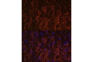 Immunofluorescence analysis of mouse brain using SNX13 antibody (ABIN6129554, ABIN6148236, ABIN6148237 and ABIN6216585) at dilution of 1:100. (SNX13 antibody  (AA 50-230))