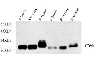 Western Blot analysis of various samples using THY1 Polyclonal Antibody at dilution of 1:1000. (CD90 antibody)