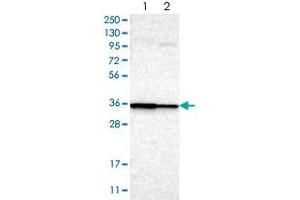 Western blot analysis of Lane 1: RT-4, Lane 2: U-251MG sp with LAX1 polyclonal antibody  at 1:100-1:250 dilution. (LAX1 antibody)