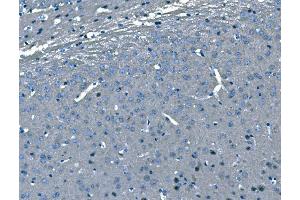 IHC analysis of B Raf/BRAF using anti-B Raf/BRAF antibody (ABIN3043761).