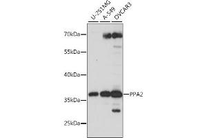 Western blot analysis of extracts of various cell lines, using PP antibody (ABIN7269763) at 1:1000 dilution. (PPA2 antibody  (AA 33-100))