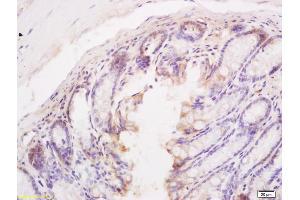 Formalin-fixed and paraffin embedded mouse intestine tissue labeled with Anti BIM/BCL2L11 Polyclonal Antibody, Unconjugated (ABIN687277) at 1:200 followed by conjugation to the secondary antibody and DAB staining (BIM antibody  (AA 51-150))