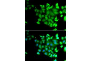 Immunofluorescence analysis of A549 cell using TET3 antibody.