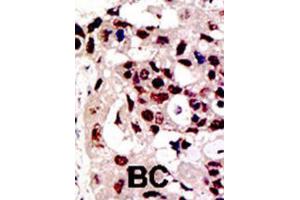 Immunohistochemistry (IHC) image for anti-Protein Inhibitor of Activated STAT, 3 (PIAS3) antibody (ABIN2996753) (PIAS3 antibody)