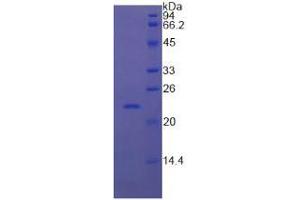 SDS-PAGE analysis of Cow RBP4 Protein. (RBP4 Protein)