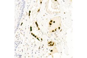 Immunohistochemistry of paraffin-embedded human esophagus using Neutrophil Elastase (ELANE) Rabbit pAb (ABIN6131604, ABIN6140110, ABIN6140111 and ABIN6216843) at dilution of 1:25 (40x lens). (ELANE antibody  (AA 30-267))