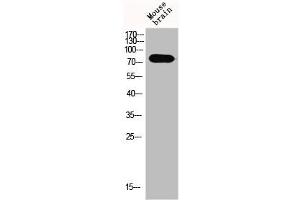 Western Blot analysis of MOuse-brain cells using Epsin 1 Polyclonal Antibody (Epsin 1 antibody  (Internal Region))