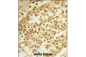 Formalin-fixed and paraffin-embedded human testis tissue reacted with RPL31 Antibody (Center), which was peroxidase-conjugated to the secondary antibody, followed by DAB staining. (RPL31 antibody  (AA 24-51))