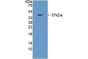 Detection of Recombinant KEAP1, Human using Polyclonal Antibody to Kelch Like ECH Associated Protein 1 (KEAP1) (KEAP1 antibody  (AA 327-624))